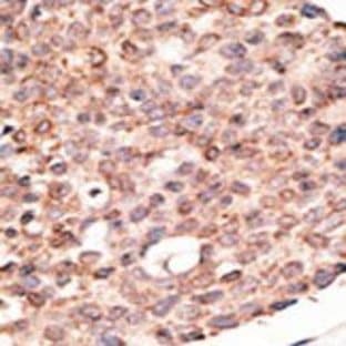 anti-Cryptochrome 2 (Photolyase-Like) (CRY2) (C-Term) antibody avatar