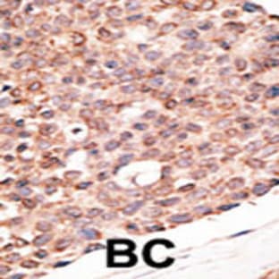 anti-Cryptochrome 2 (Photolyase-Like) (CRY2) (C-Term), (AA 564-593) antibody avatar