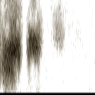 anti-Crystallin, alpha A (CRYAA) antibody avatar