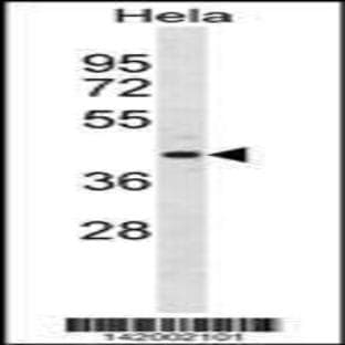 anti-ADP-Ribosylarginine Hydrolase (ADPRH) (C-Term), (AA 306-334) antibody avatar