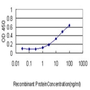 anti-Crystallin, alpha B (CRYAB) (AA 1-176) antibody avatar