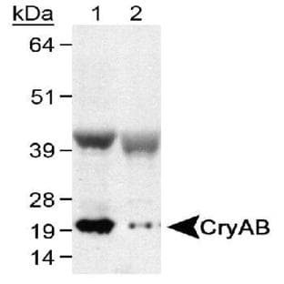 anti-Crystallin, alpha B (CRYAB) (C-Term), (AA 100-175) antibody avatar