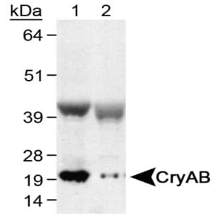anti-Crystallin, alpha B (CRYAB) (C-Term), (AA 100-175) antibody avatar
