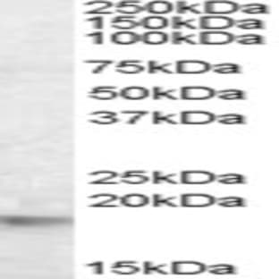anti-Crystallin, alpha B (CRYAB) (Internal Region) antibody avatar