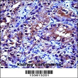 anti-Crystallin, alpha B (CRYAB) (AA 84-112), (Center) antibody avatar