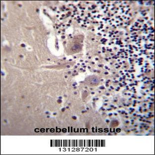 anti-Crystallin, beta A1 (CRYBA1) (AA 104-133), (Center) antibody avatar