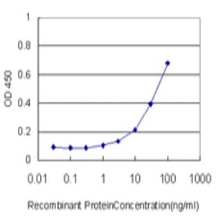 anti-Crystallin, beta B1 (CRYBB1) (AA 37-138) antibody avatar