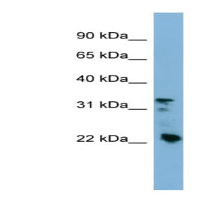 anti-Crystallin, beta B3 (CRYbB3) (Middle Region) antibody avatar