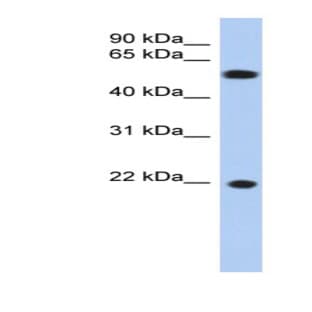 anti-Crystallin, gamma C (CRYGC) (Middle Region) antibody avatar