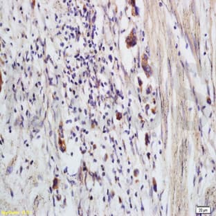 anti-Crystallin, gamma D (CRYGD) antibody avatar