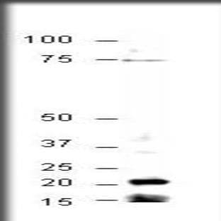 anti-Crystallin, gamma S (CRYGS) (N-Term), (AA 19-37) antibody avatar