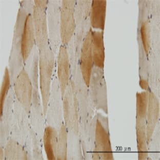 anti-Crystallin, mu (CRYM) (AA 215-315) antibody avatar