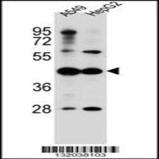 anti-Chromosome 10 Open Reading Frame 129 (C10ORF129) (C-Term), (AA 433-460) antibody avatar