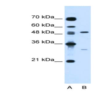 anti-Colony Stimulating Factor 1 (Macrophage) (CSF1) (N-Term) antibody avatar