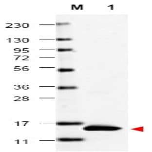 anti-Colony Stimulating Factor 2 (Granulocyte-Macrophage) (CSF2) antibody avatar