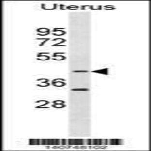 anti-Colony Stimulating Factor 2 Receptor, Alpha, Low-Affinity (Granulocyte-Macrophage) (CSF2RA) (C-Term), (AA 366-394) antibody avatar