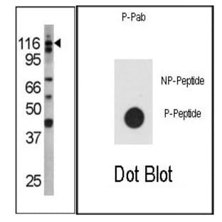 anti-Colony Stimulating Factor 2 Receptor, Beta, Low-Affinity (Granulocyte-Macrophage) (CSF2RB) (pTyr766) antibody avatar