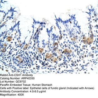anti-Chorionic Somatomammotropin Hormone 1 (Placental Lactogen) (CSH1) (Middle Region) antibody avatar