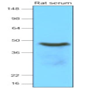 anti-serpin Peptidase Inhibitor, Clade A (Alpha-1 Antiproteinase, Antitrypsin), Member 12 (SERPINA12) (AA 21-414) antibody avatar