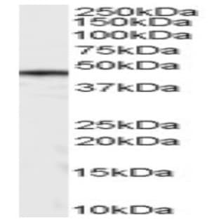 anti-Casein Kinase 1, delta (CSNK1D) (Internal Region) antibody avatar