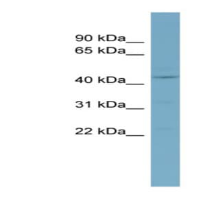anti-Casein Kinase 1, delta (CSNK1D) (Middle Region) antibody avatar