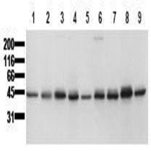 anti-Casein Kinase 1, epsilon (CSNK1E) (AA 355-380) antibody avatar