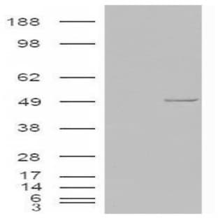 anti-Casein Kinase 1, epsilon (CSNK1E) (C-Term) antibody avatar