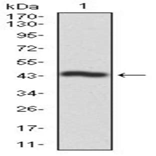 anti-Casein Kinase 2, alpha Prime Polypeptide (CSNK2A2) (AA 194-350) antibody avatar