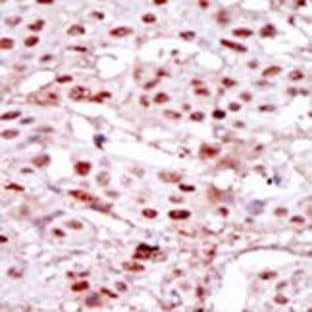 anti-Casein Kinase 2, alpha 1 Polypeptide (CSNK2A1) (Middle Region) antibody avatar