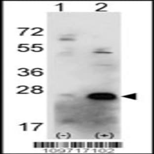 anti-Casein Kinase 2, beta (CSNK2B) (C-Term), (AA 153-184) antibody avatar