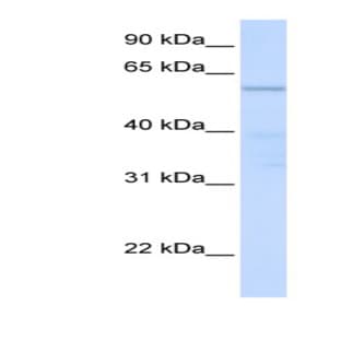 anti-Chromosome 16 Open Reading Frame 71 (C16ORF71) (Middle Region) antibody avatar