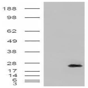 anti-Cysteine and Glycine-Rich Protein 2 (CSRP2) (Internal Region) antibody avatar