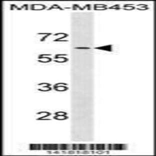 anti-Adrenergic, alpha-1B-, Receptor (ADRA1B) (C-Term), (AA 380-409) antibody avatar