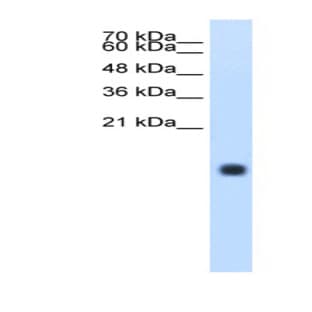 anti-Cystatin S (CST4) (N-Term) antibody avatar