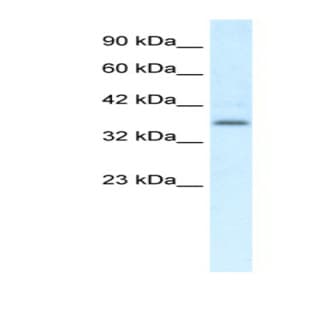 anti-Chemokine-Like Receptor 1 (CMKLR1) (C-Term) antibody avatar