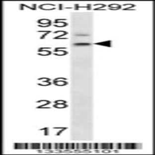 anti-Adenomatosis Polyposis Coli Down-Regulated 1 (APCDD1) (N-Term), (AA 69-98) antibody avatar
