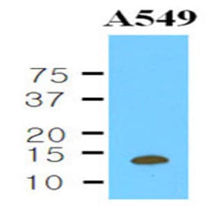 anti-Cystatin B (Stefin B) (CSTB) (AA 1-98), (N-Term) antibody avatar