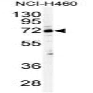 anti-Cleavage Stimulation Factor, 3' Pre-RNA, Subunit 2, 64kDa (CSTF2) (N-Term) antibody avatar