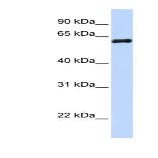 anti-Cleavage Stimulation Factor, 3' Pre-RNA, Subunit 2, 64kDa (CSTF2) (N-Term) antibody avatar