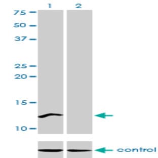 anti-Cleavage Stimulation Factor, 3' Pre-RNA, Subunit 3, 77kDa (CSTF3) (AA 1-104) antibody avatar
