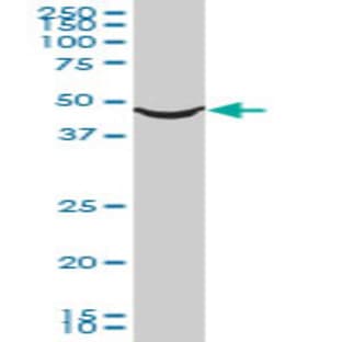 anti-Adrenoceptor alpha 1A (ADRA1A) (AA 1-28) antibody avatar