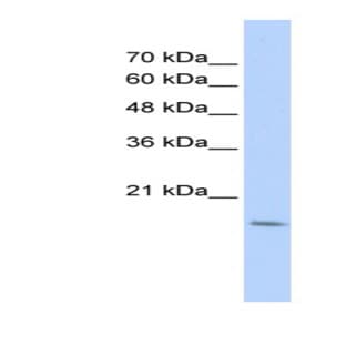 anti-CDC42 Effector Protein (Rho GTPase Binding) 5 (CDC42EP5) (Middle Region) antibody avatar