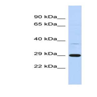 anti-Chromosome 1 Open Reading Frame 74 (C1ORF74) (N-Term) antibody avatar