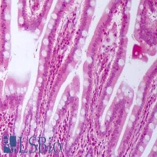 anti-Connective Tissue Growth Factor (CTGF) antibody avatar