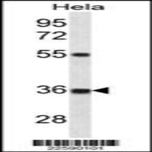 anti-Connective Tissue Growth Factor (CTGF) (AA 166-193), (C-Term) antibody avatar