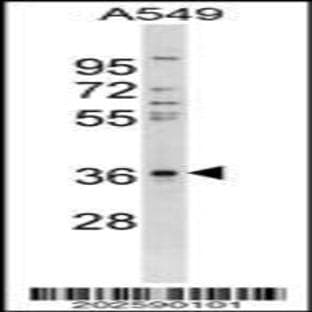 anti-Connective Tissue Growth Factor (CTGF) (AA 166-193), (C-Term) antibody avatar