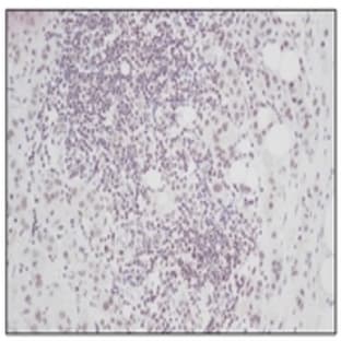 anti-Connective Tissue Growth Factor (CTGF) antibody avatar