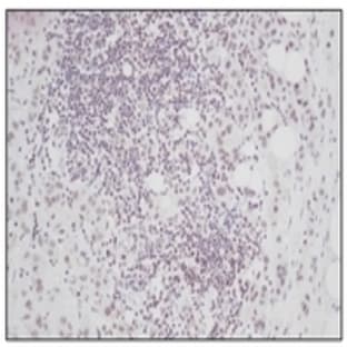 anti-Connective Tissue Growth Factor (CTGF) antibody avatar