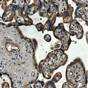 anti-Connective Tissue Growth Factor (CTGF) antibody avatar