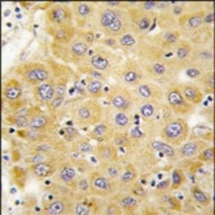 anti-Connective Tissue Growth Factor (CTGF) (C-Term) antibody avatar